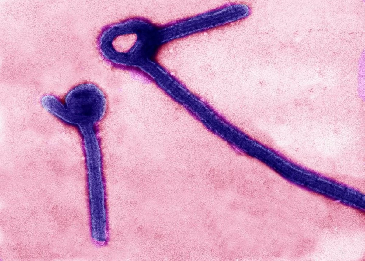 A transmission electron micrograph image of Ebola virus. REUTERS/USAMRIID/Handout