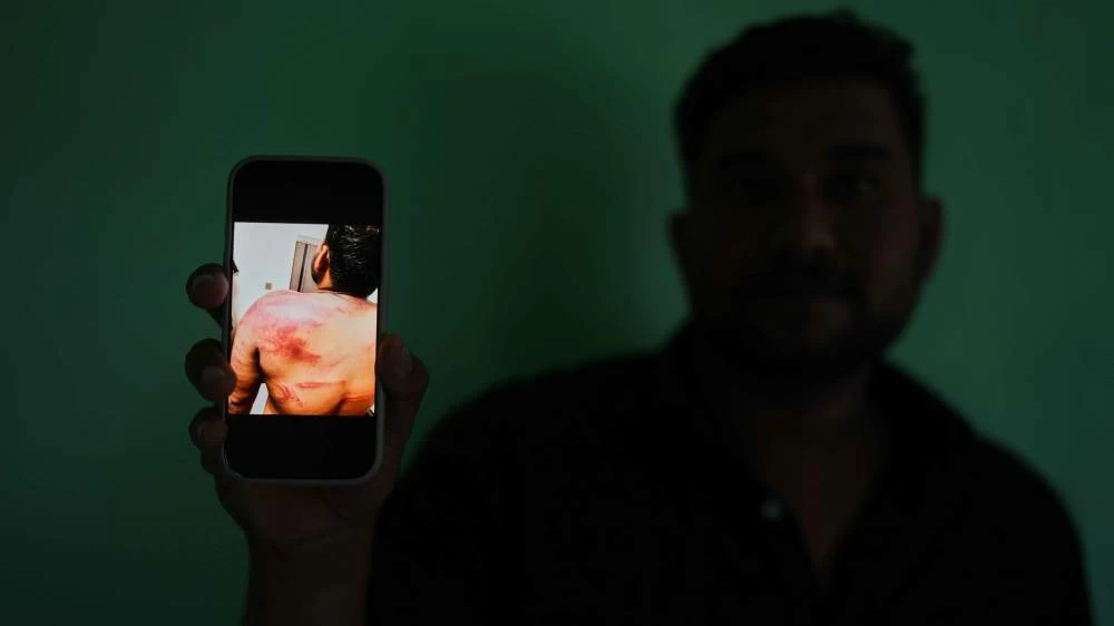 Safeer Mohammed Koorimannil displays a photograph on his mobile phone documenting injuries he said he sustained when his employers at the Tai Chang scam compound in Myanmar, beat him for underperformance in Sulthan Bathery in the southern state of Kerala, India, Thursday, March 12, 2026. (AP)