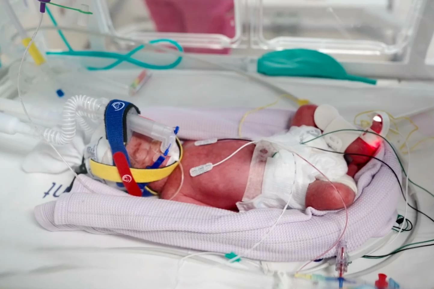 Australian Woman Gives Birth to Rare Naturally Conceived Identical Quadruplet Girls