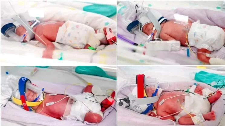 The babies are doing well in the neonatal intensive care unit and their names are Emily, Harriet, Catherine and Alexa, in honor of Bendall. (Courtesy of Metro North Health)
