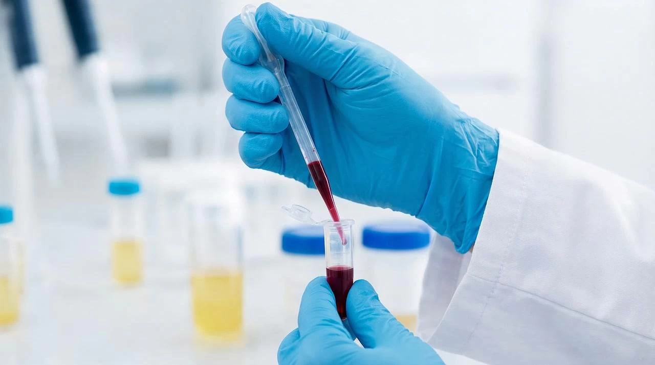 Platelets refrigerated for up to three weeks were just as effective at treating bleeding as the room-temperature platelets, the researchers reported in JAMA