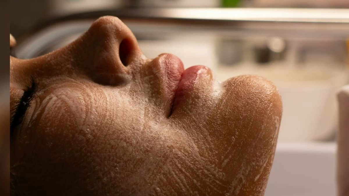 Acne is caused by many factors including genetics, hormones, environment and even diet - like eating excessive amounts of dairy. The causes of facial and body acne are similar, although skin bacteria sometimes plays a larger role in body acne. (Photo for illustrative purposes only by kimia kazemi on Unsplash)